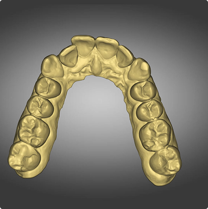 Tooth segmentation