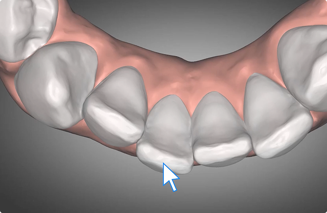 Real-time tooth overlay display
