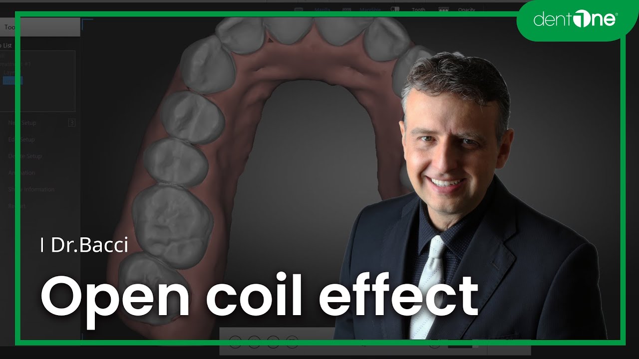 #3 Open coil effect